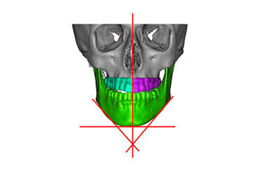 Planificación ortognática