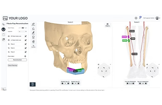 3D Surgical Platform