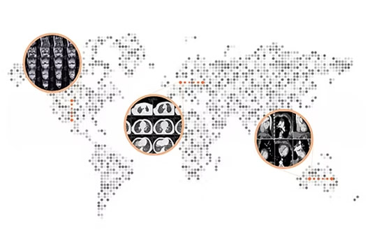Global Data Acquisition